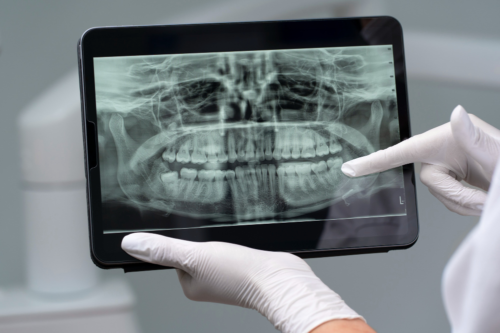Digital X-Rays  Totowa, NJ