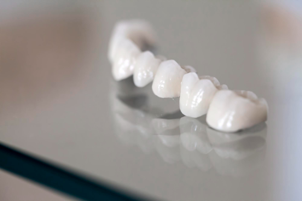 Porcelain Crowns in Totowa