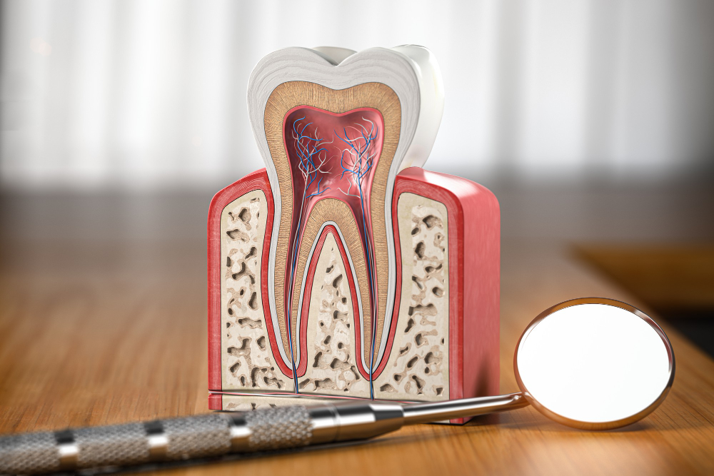 Root Canals in Totowa