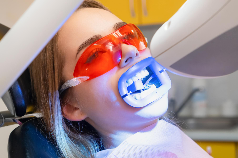 Teeth Whitening Totowa, NJ